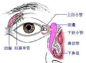 泪道阻塞怎么办?治疗方法